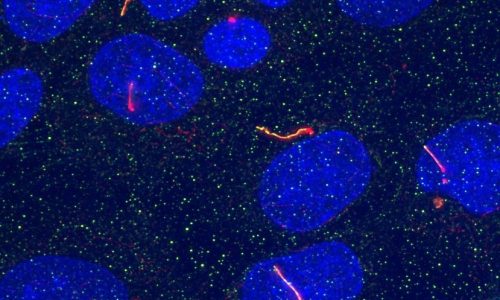 imcd_cilia